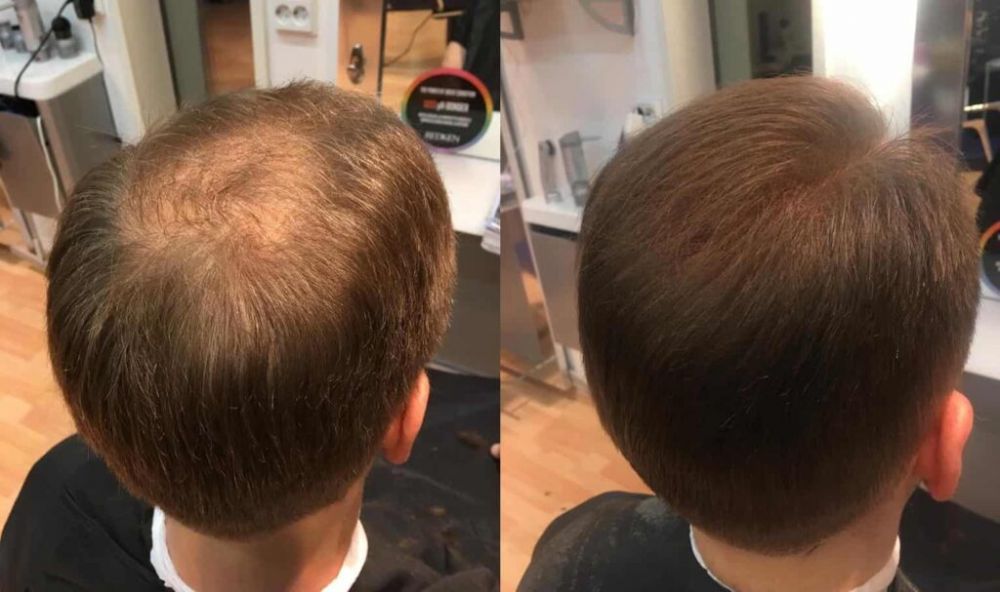 Alt du bør vite før du kjøper parykk